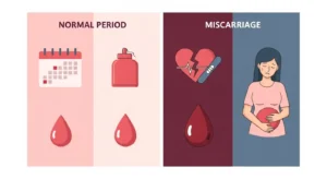 Period or Miscarriage